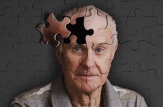 болезнь Альцгеймера что это такое